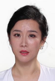 王蕊